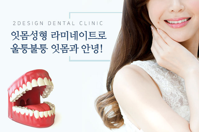 잇몸성형 라미네이트로 울퉁불퉁 잇몸과 안녕!