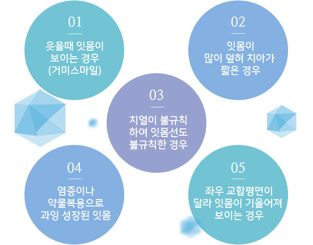 잇몸성형 적용대상